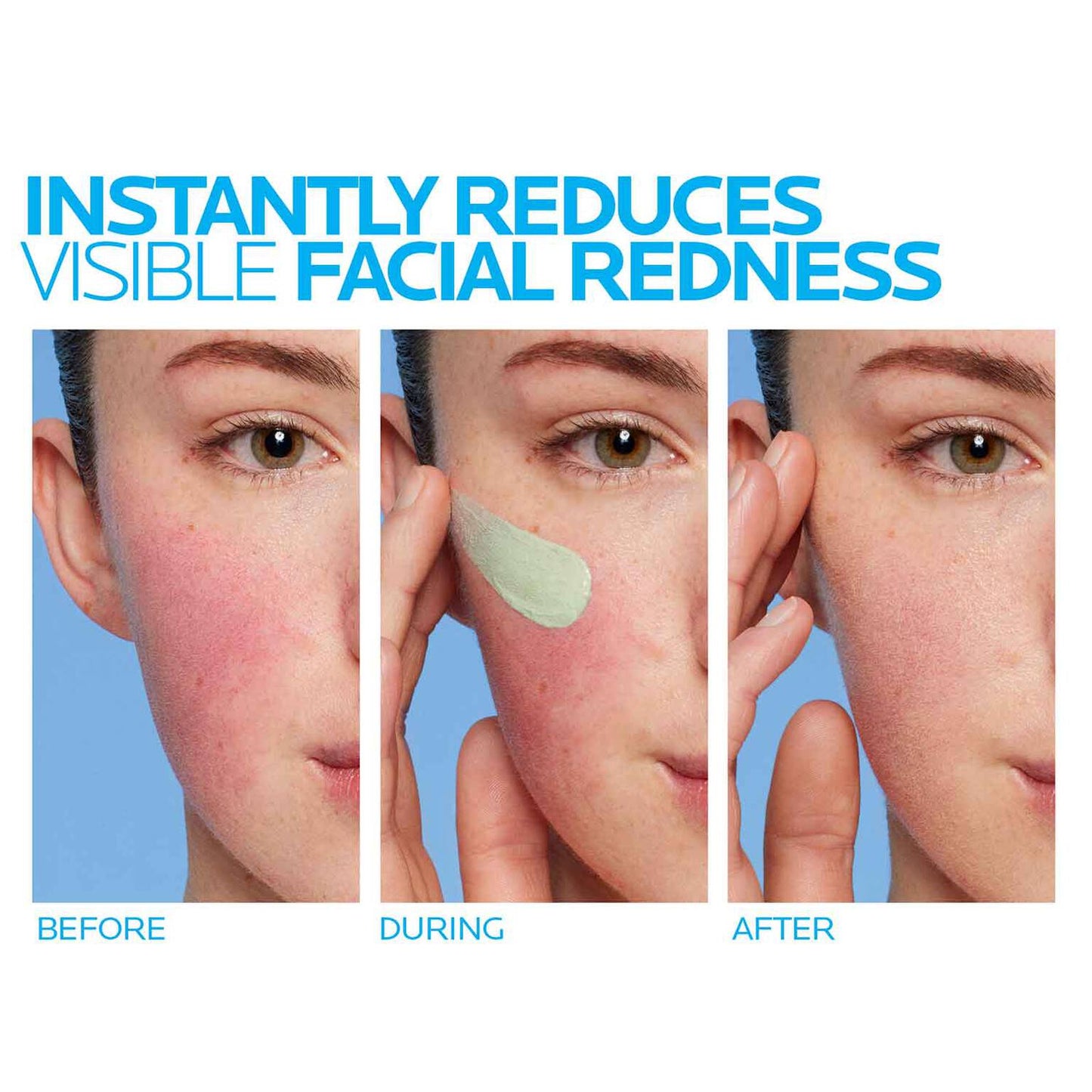 toleriane-rosaliac-ar-face-cream-for-visible-redness-u3 8_Toleriane_Rosaliac-AR-before-after.jpg