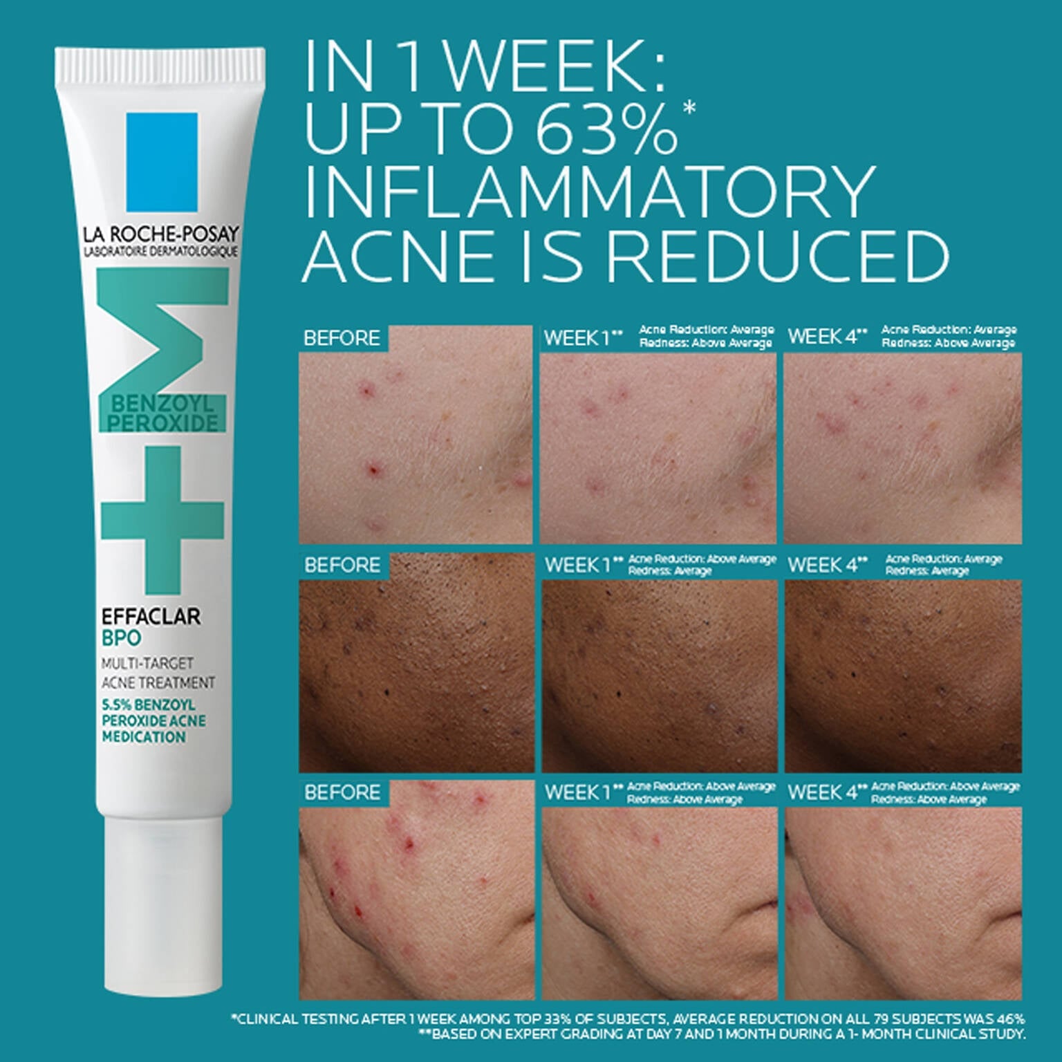 effaclar-bpo-multi-target-acne-treatment-with-5-5-benzoyl-peroxide-t6 EffaclarBPO-ClinicalBA-ATF-1500x1500-2.jpg