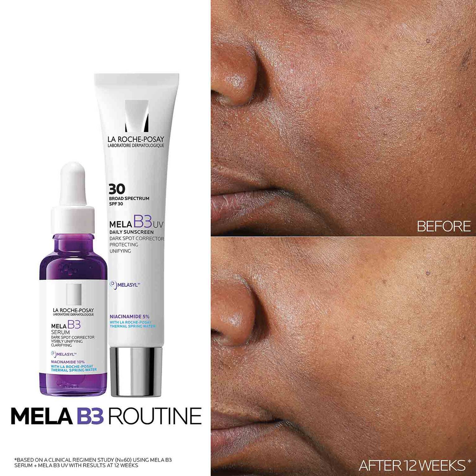 mela-b3-dark-spot-serum-with-melasyltm-niacinamide-r6 Mela-B3-routine_1500X1500.jpg