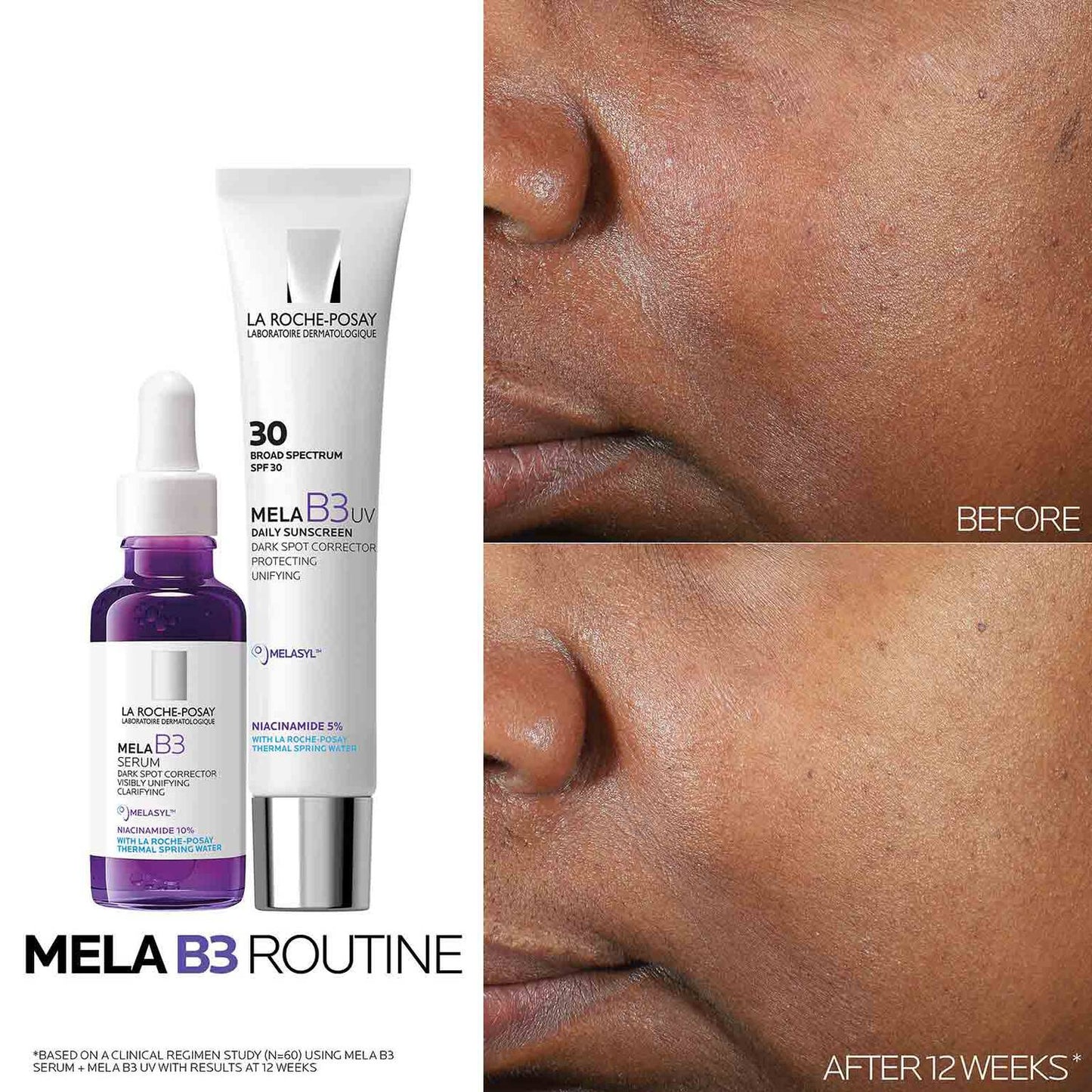 mela-b3-uv-daily-moisturizer-spf-30-with-melasyltm-niacinamide-j8 Mela-B3-routine_1500X1500.jpg