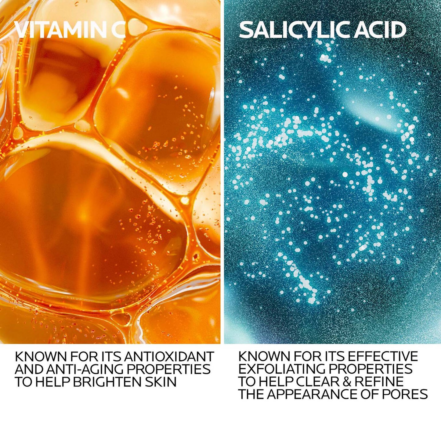vitamin-c12-oil-control-serum-for-oily-skin-y2 VitaminC12_OilControl-KEY-DERMATOLOGICAL-INGREDIENT-REV-1500x1500.jpg