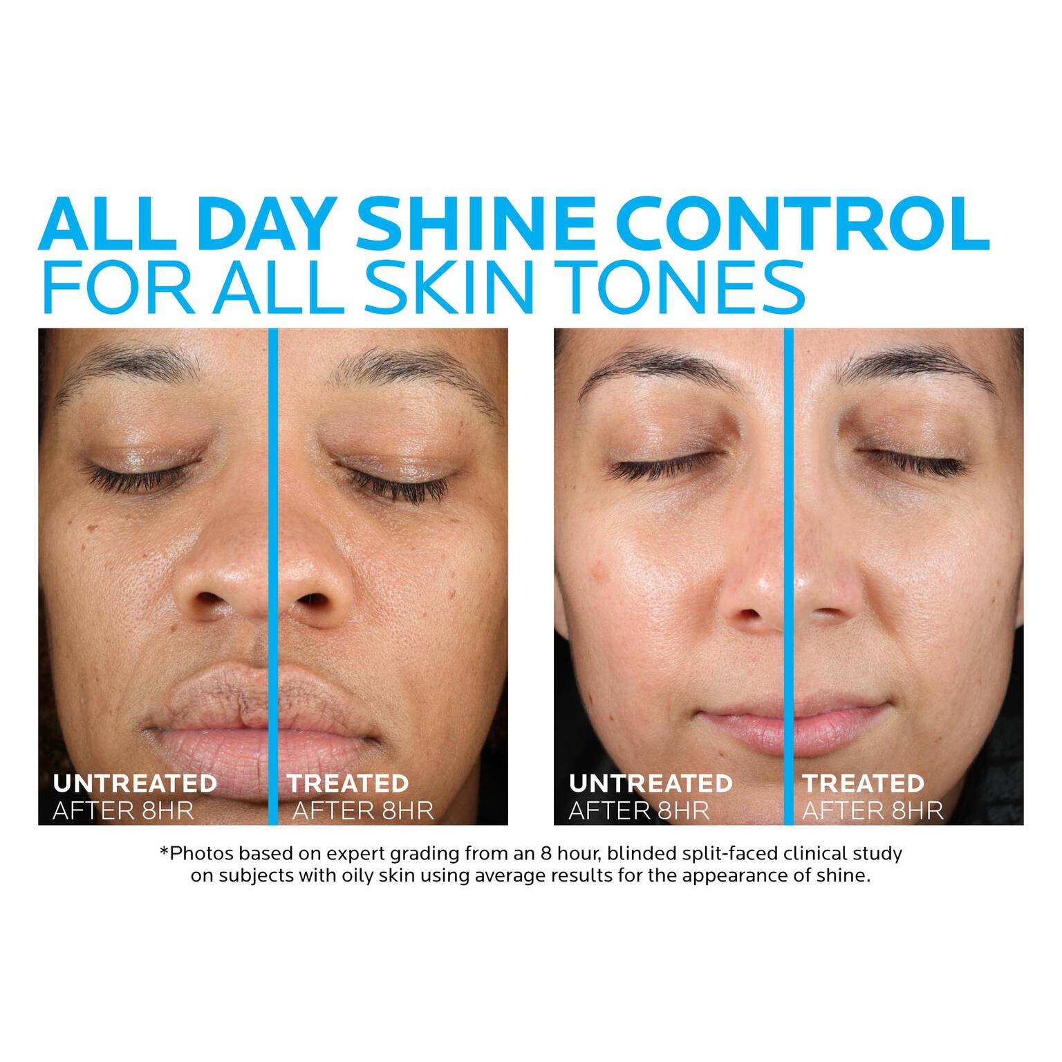 toleriane-double-repair-matte-face-moisturizer-for-oily-skin-o3 la-roche-posay-toleriane-matte-moisturizer-before-and-after-pdp-alt.jpg